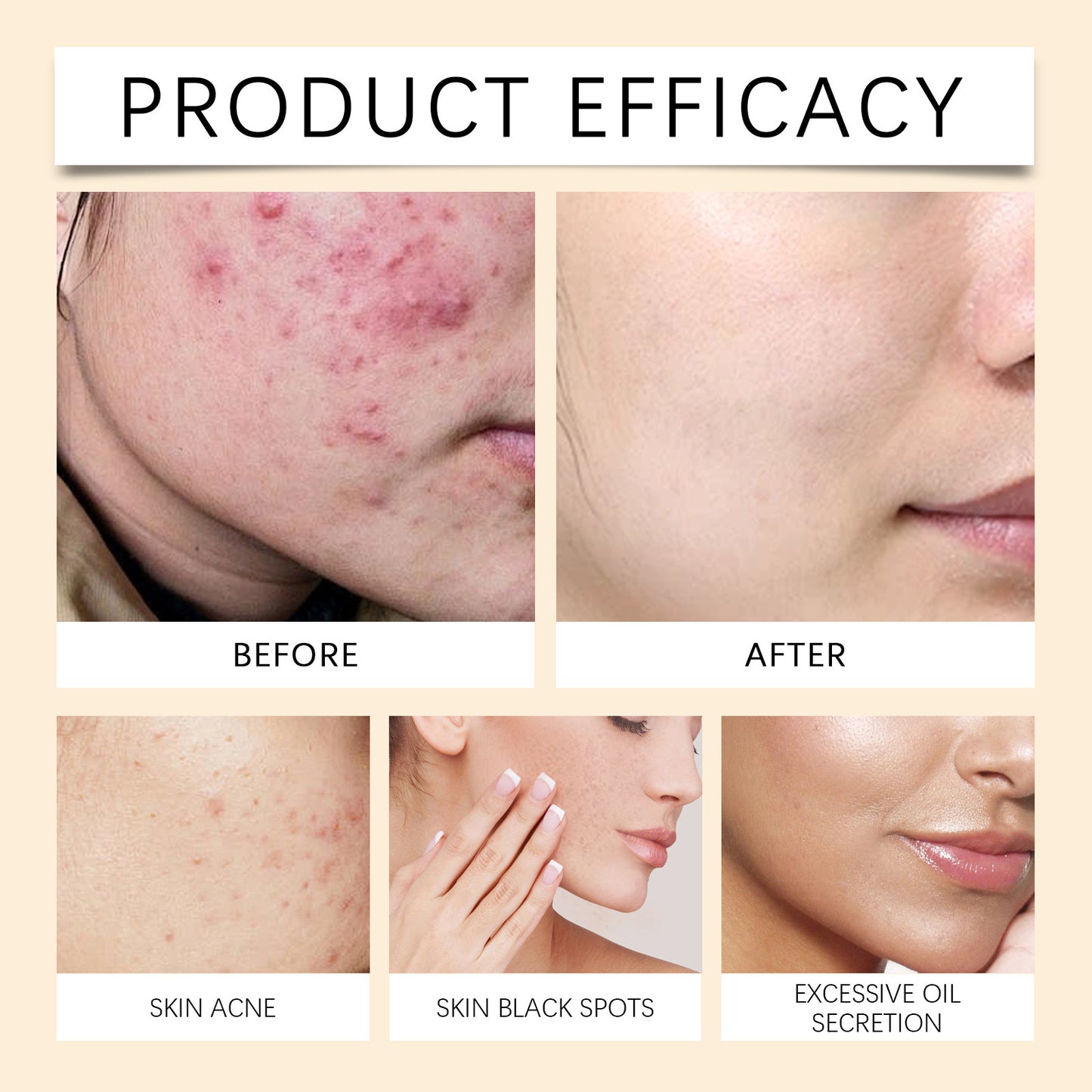 Moisturize Face Cream