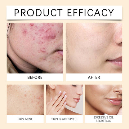 Moisturize Face Cream